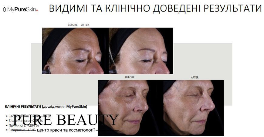 Морський колаген для пружності та еластичності шкіри, My Collagen Lift, MyPureSkin MyCollagenLift фото