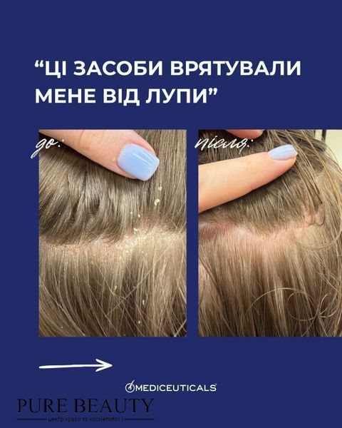 Шампунь проти лупи, себорейного дерматиту та різних проблем шкіри голови X-Folate, Mediceuticals 54003 фото