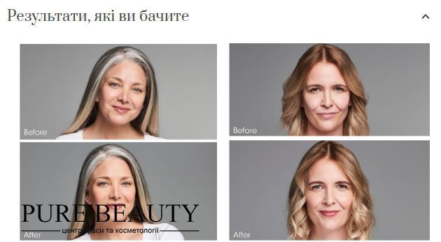 Лікувальна тональна основа для покращення кольору обличчя, No Makeup Foundation Serum Broad Spectrum SPF 20,  Perricone MD 12188333 фото